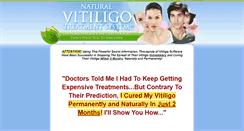 Desktop Screenshot of naturalvitiligotreatmentsystem.com