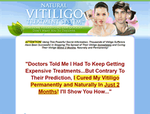 Tablet Screenshot of naturalvitiligotreatmentsystem.com